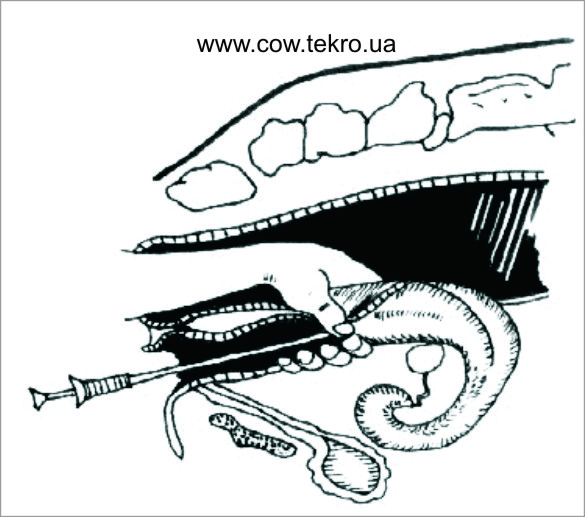 Shema rektocervіkalnogo osіmenіnnja korіv