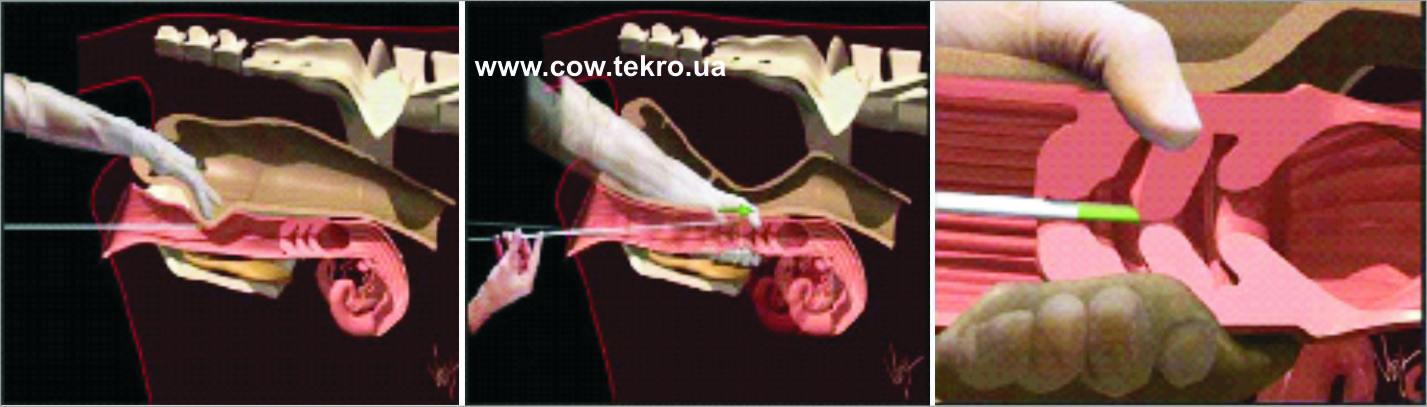 Shema vvedennja katetera v shijku matki korovі
