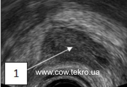 Exograma yayechnyka korovy za gipofunkciyi